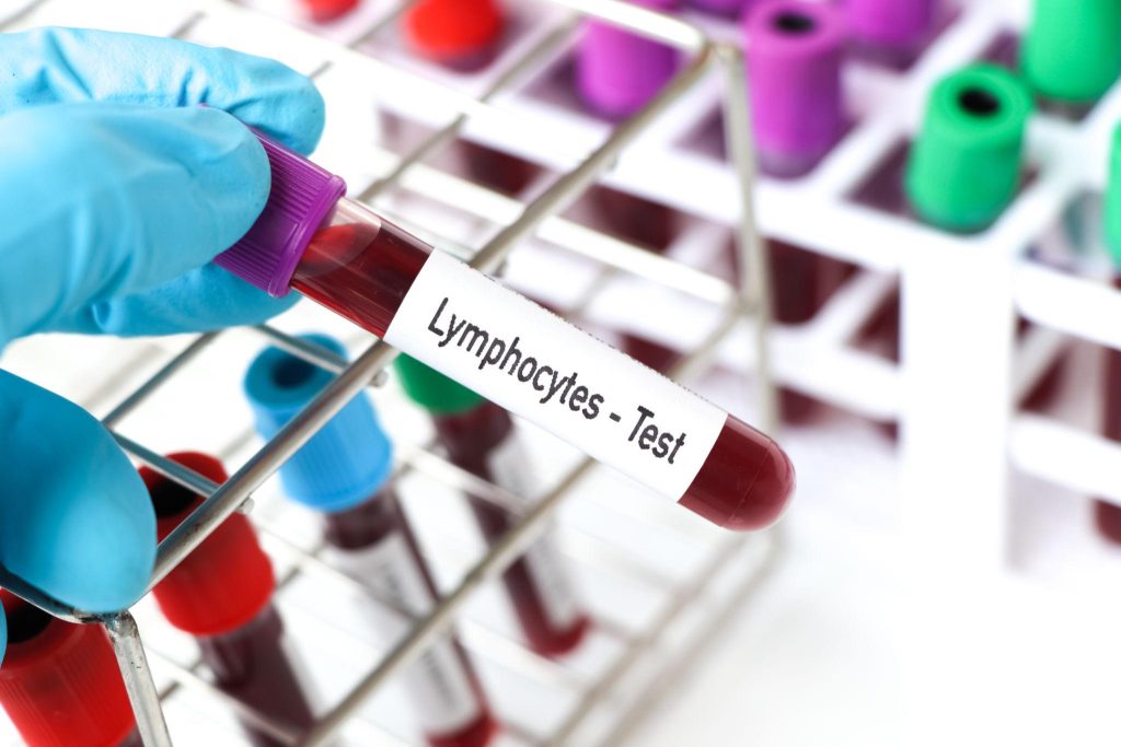 LYM در آزمایش خون چیست و بالا یا پایین بودن آن یعنی چه؟