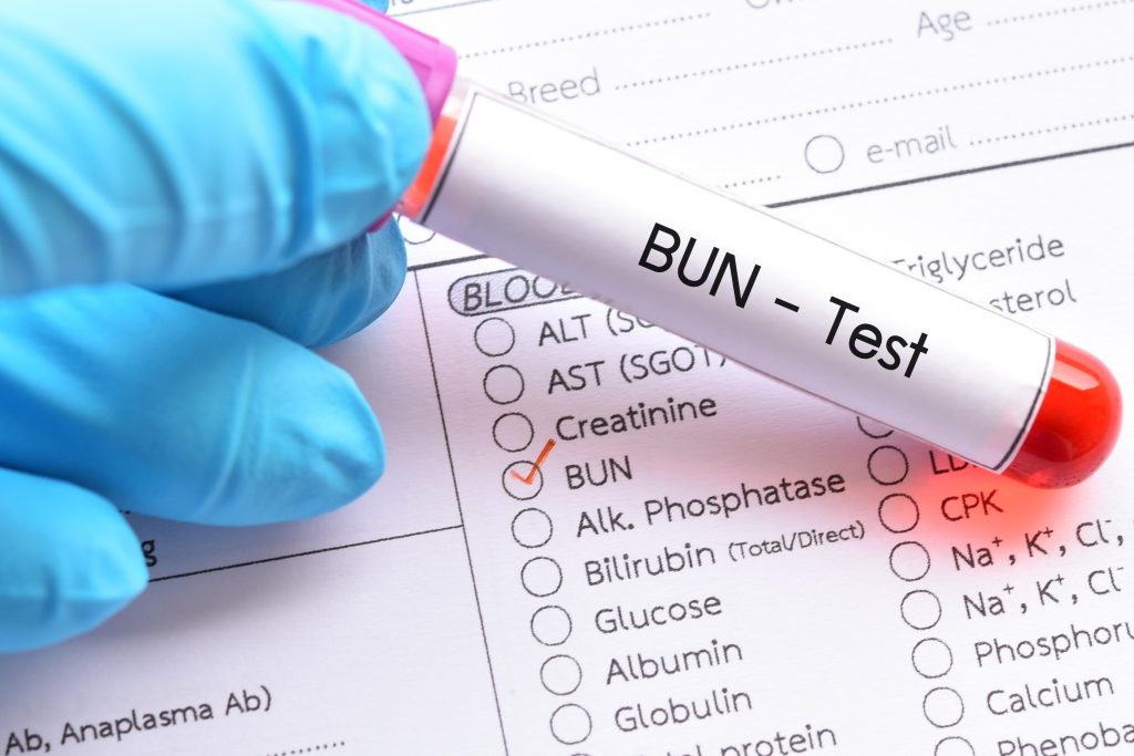 اوره در آزمایش خون چیست؟ مقدار طبیعی BUN و علت بالا یا پایین بودن آن
