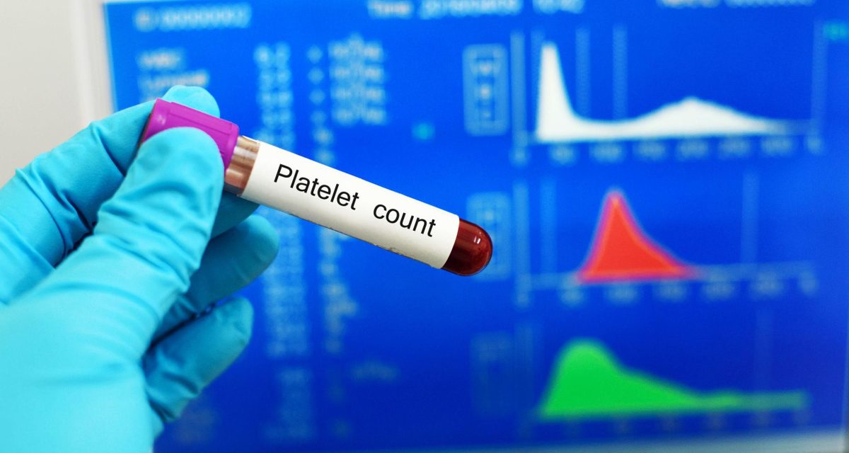 PLT در آزمایش خون چیست؟ مقدار نرمال پلاکت چقدر است؟