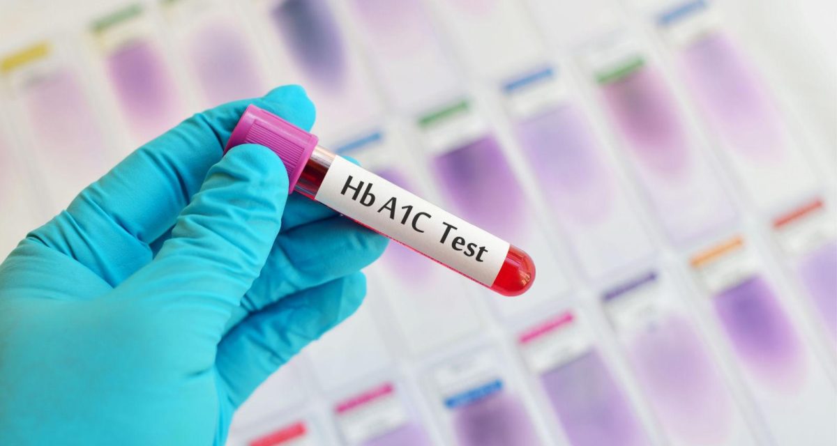 HbA1c در آزمایش خون چیست + تفسیر عدد قند سه‌ماهه