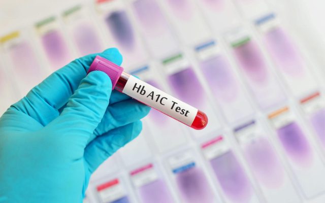 HbA1c در آزمایش خون چیست + تفسیر عدد قند سه‌ماهه