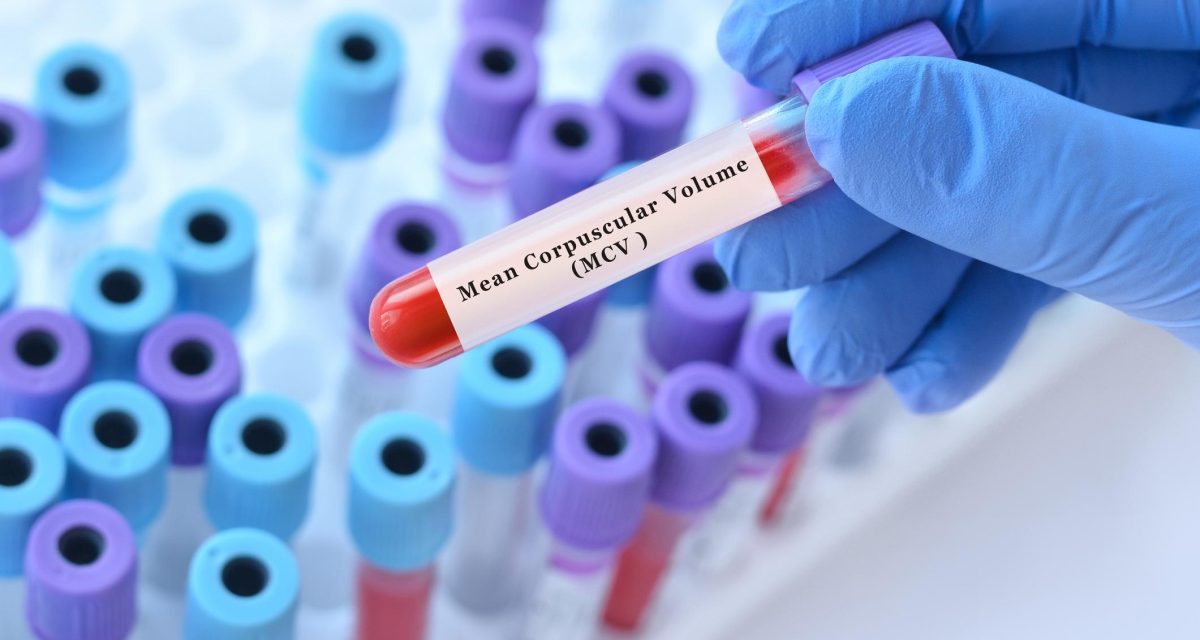 MCV در آزمایش خون چیست؟ بررسی MCV بالا و پایین و ارتباط آن با کم‌خونی