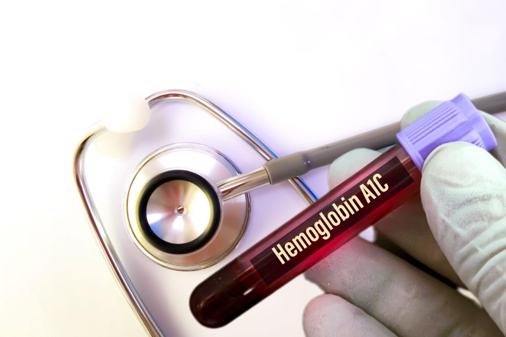 HbA1c در آزمایش خون چیست + تفسیر عدد قند سهماهه