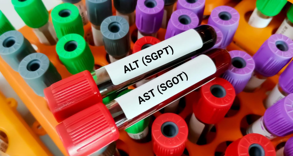 ALT و SGPT در آزمایش خون چیست؟