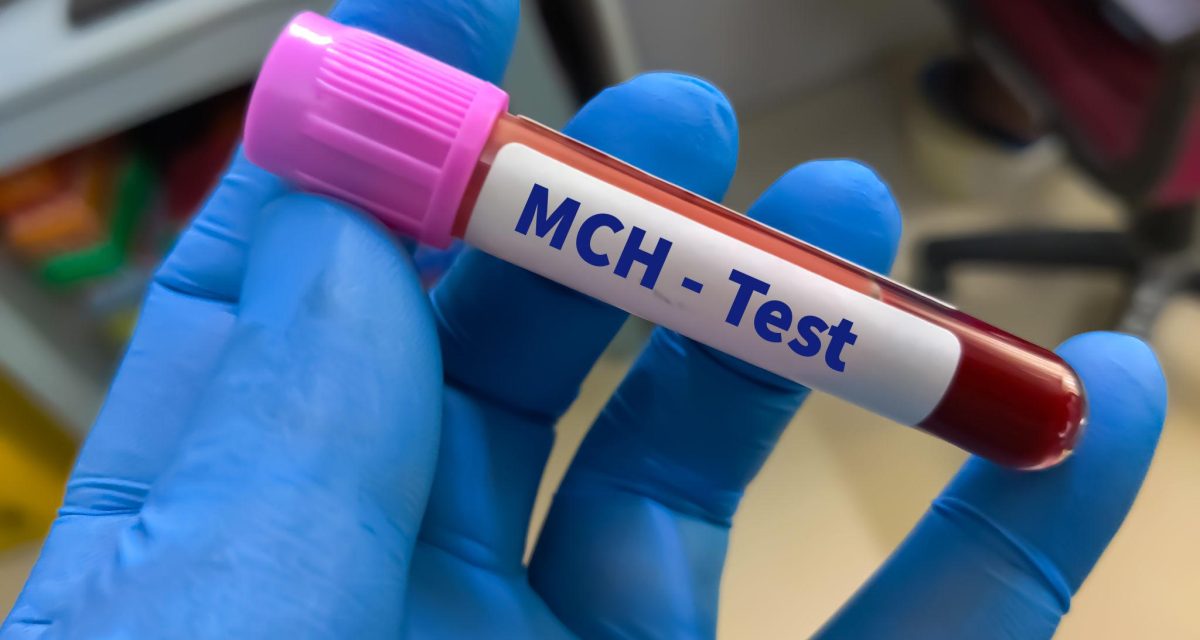 MCH در آزمایش خون چیست؟ علت پایین یا بالا بودن MCH