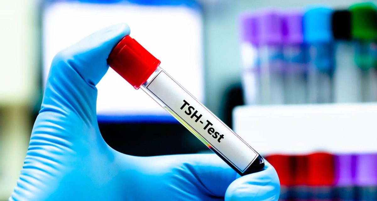 TSH در آزمایش خون چیست؟ تفسیر TSH بالا و پایین + محدوده طبیعی و ارتباط آن با تیروئید