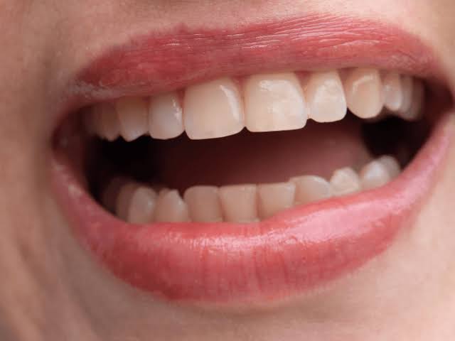 تلخی دهان چگونه از بین میرود؟