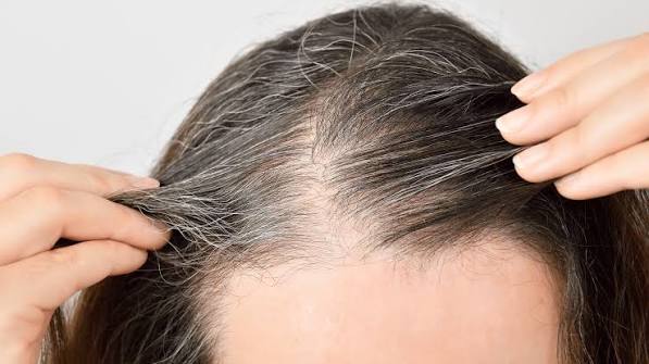 ریزش مو چیست؟ علت + بهترین روش‌های درمان
