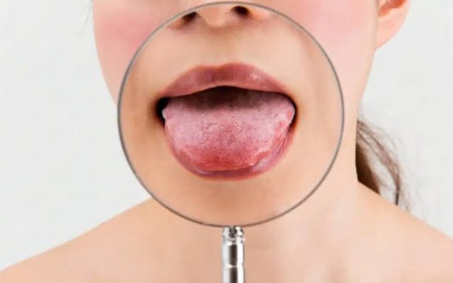 علت تلخی دهان چیست؟ درمان تلخی دهان + علت‌های شایع آن