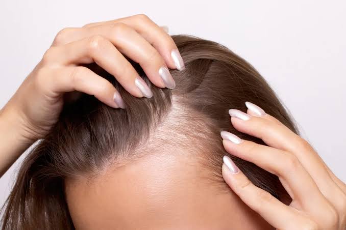 علت ریزش مو چیست؟ دلایل ریزش مو در زنان و مردان