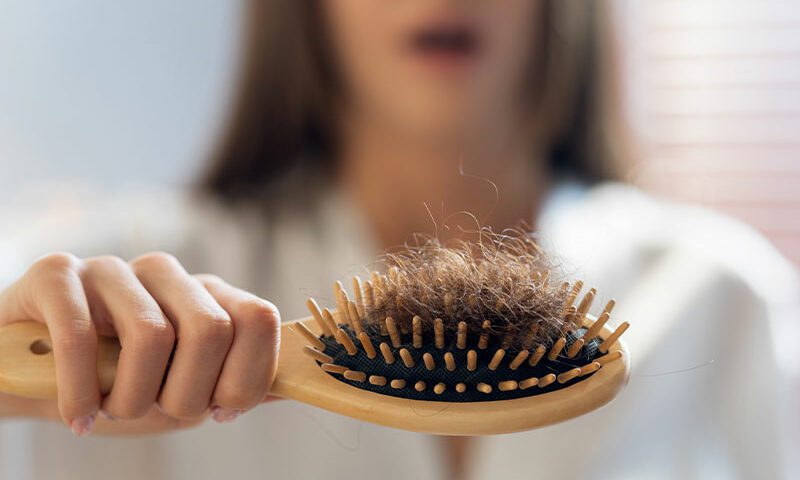علت ریزش مو چیست؟ دلایل ریزش مو در زنان و مردان