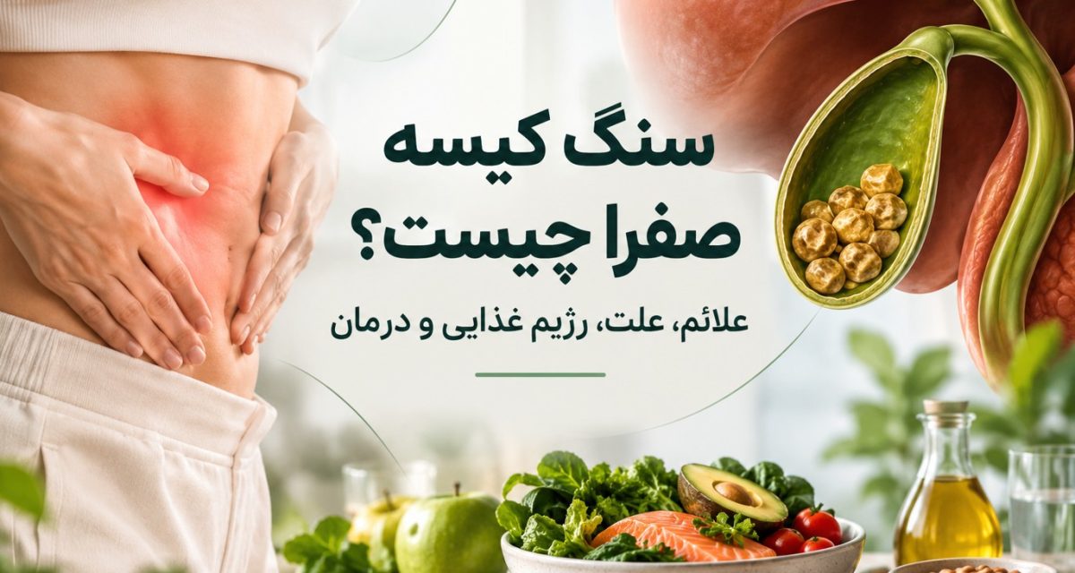 سنگ کیسه صفرا چیست؟ علائم، علت، رژیم غذایی و درمان