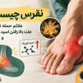 نقرس چیست؟ علائم حمله نقرس، علت بالا رفتن اسید اوریک + درمان